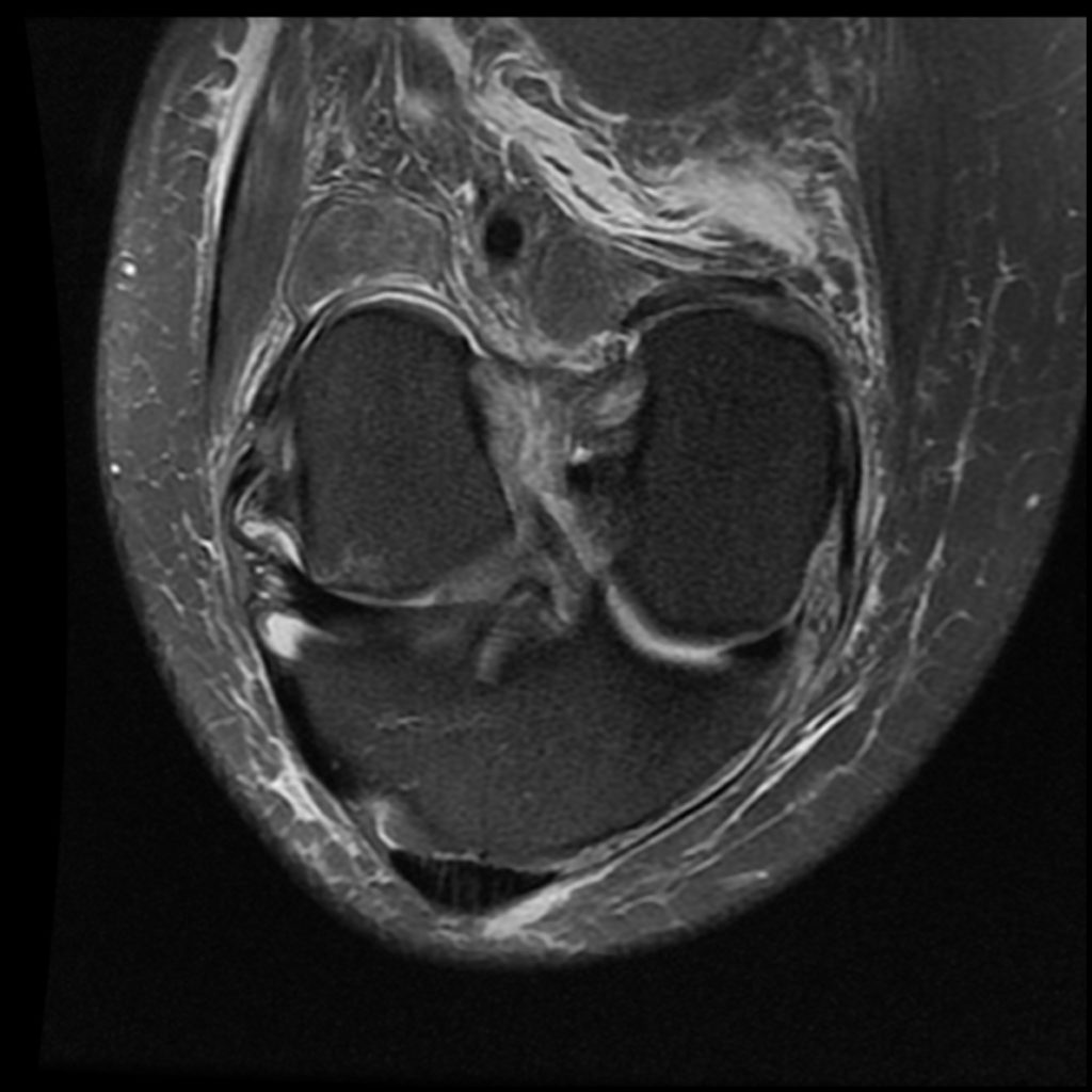 Our Results - Arizona Prolotherapy